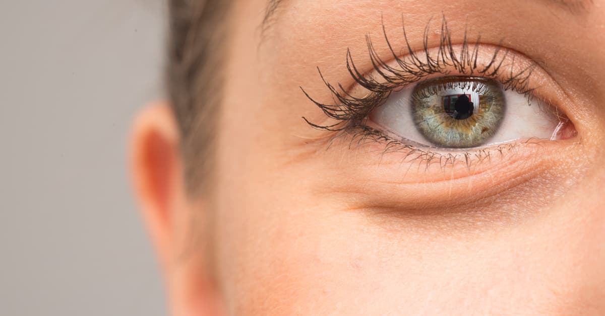Suffering From Puffy Under Eyes ! How To Get Rid Of Puffy Eyes