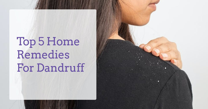 Home-Remedies-for-Dandruff-derma-essentia