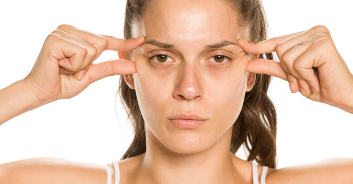 7 Best Home Remedies for dark circles under eyes that works