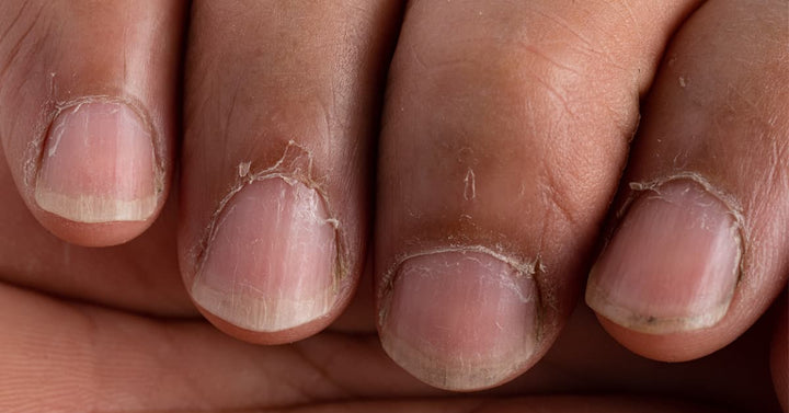 Top tips to tackle brittle nails | The Health Hub