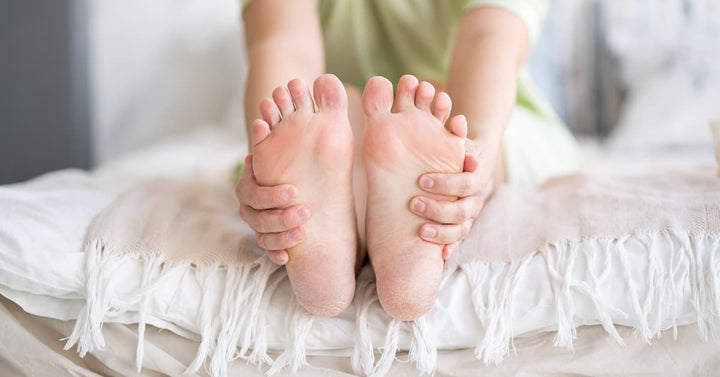 What are the causes for dry feet or cracked heels? How to treat it – Derma  Essentia