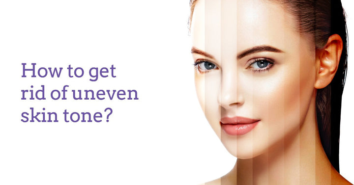 How-to-get-rid-of-uneven-skin-tone-dermaessentia