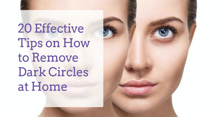 How to Remove Dark Circles in 2023  Learn 20 Effective Tips – Derma  Essentia