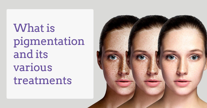 what-is-pigmentation-derma-essentia