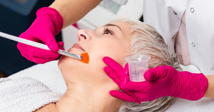 What is a Chemical Peel?  Top 5 chemical peel benefits