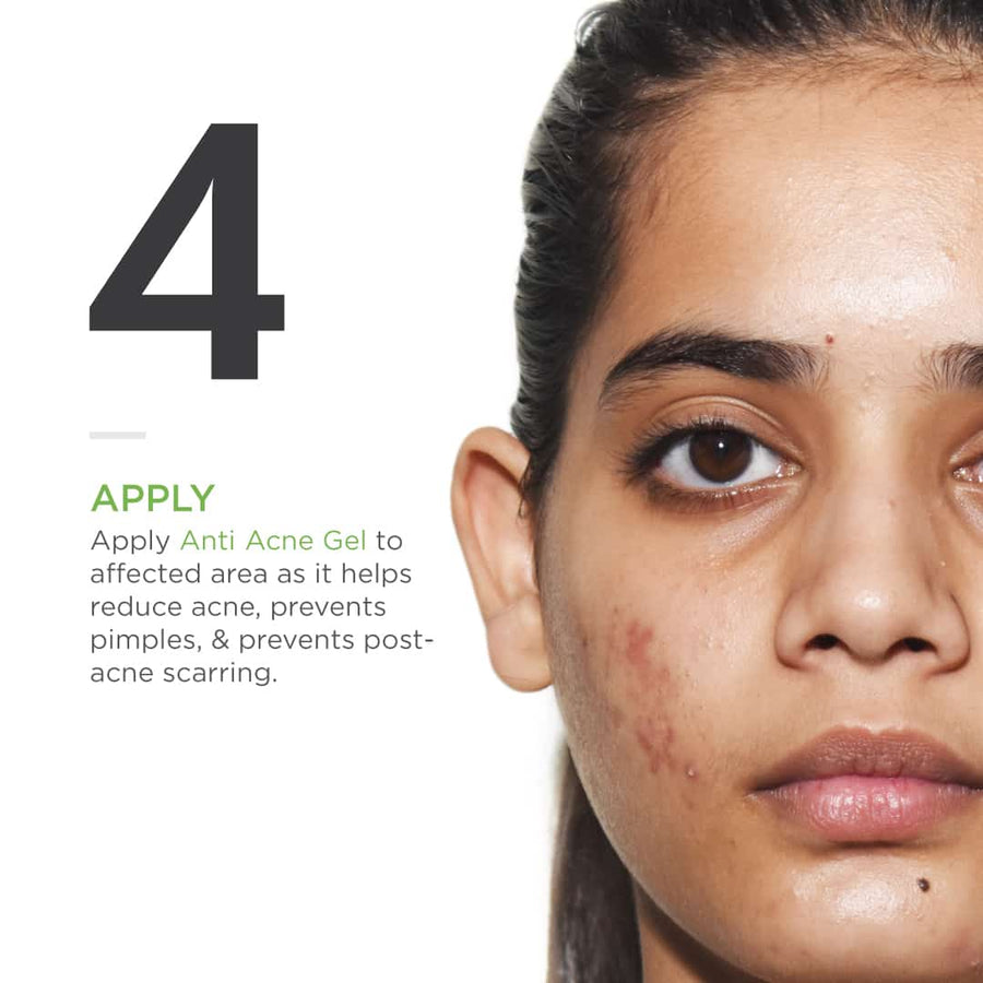 Acne Treatment Bundle for Oily Acne Prone Skin