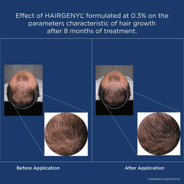 Derma Essentia HAIRGENYL DATA Results for Hair Growth Serum 